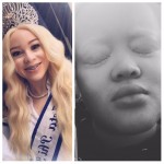 Loving the skin I’m in: Living with Albinism